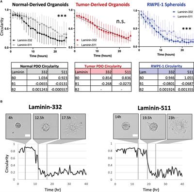 Digital image analysis using video microscopy of human-derived prostate cancer vs normal prostate organoids to assess migratory behavior on extracellular matrix proteins